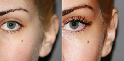 Celebrity Lashes, controindicazioni, effetti collaterali