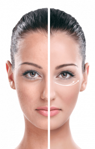 EyeLift, funziona, come si usa, composizione, ingredienti