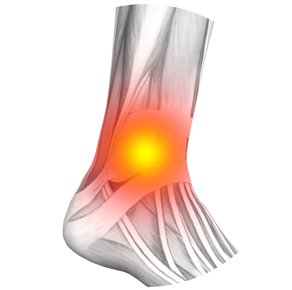 Osteodol, controindicazioni, effetti collaterali