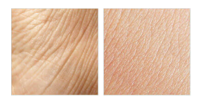 Nolatreve Skin, Italia, originale, sito ufficiale
