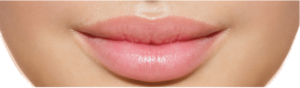 Vip's Lips, effetti collaterali, controindicazioni