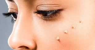 Bright Skin, effetti collaterali, controindicazioni