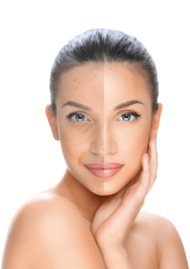 Hyaluronic Face, composizione, funziona, come si usa, ingredienti