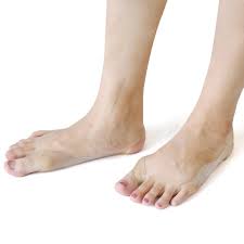 Footmate Valgus, prezzo, dove si compra, amazon
