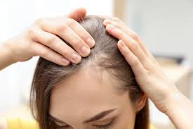 Hair Grow Max, composizione, ingredienti, funziona, come si usa