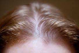 Hair Grow Max, controindicazioni, effetti collaterali