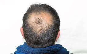 KeraHealth Hair Uomo, Italia, originale, sito ufficiale