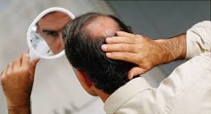 KeraHealth Hair Uomo, controindicazioni, effetti collaterali
