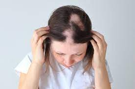 KeraHealth Hair Donna, Italia, sito ufficiale, originale